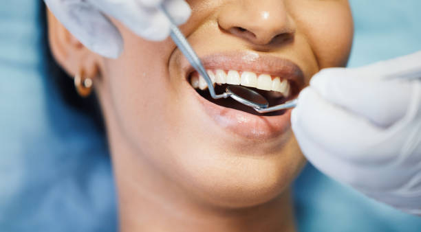 Dentist for Dental Trauma in LA